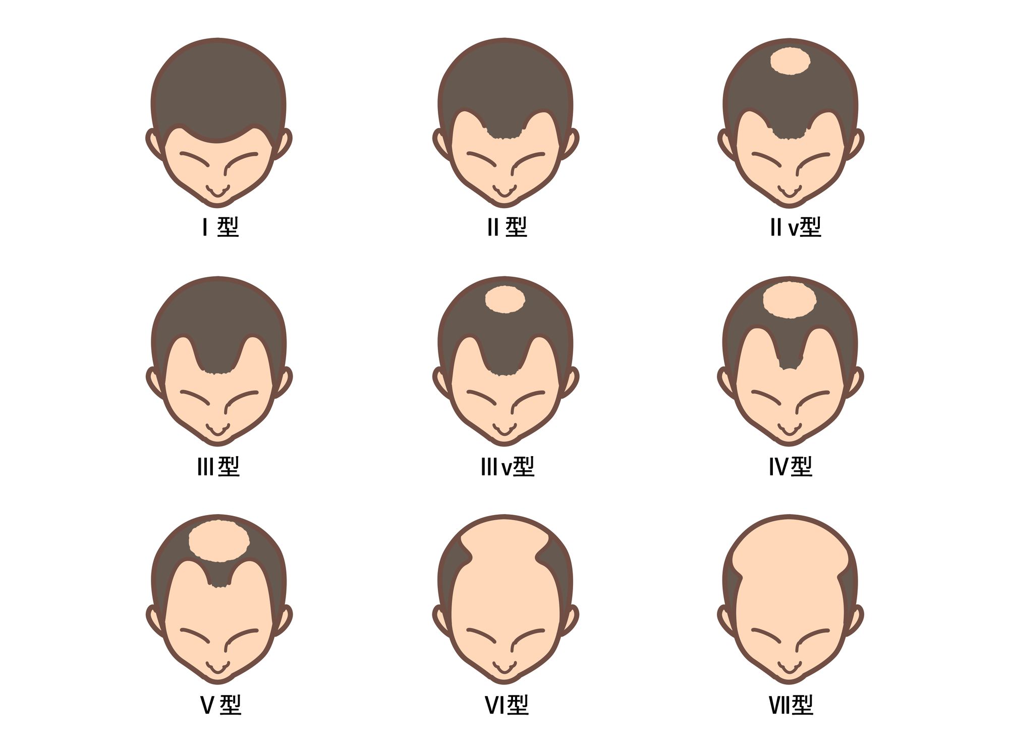 AGAセルフチェック