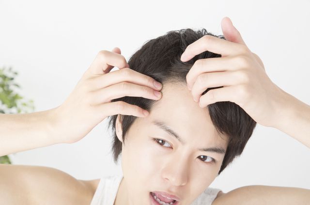 ２．AGAについて