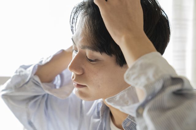 4.AGAによる薄毛の進行